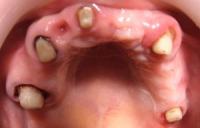 Надо чистить зубы