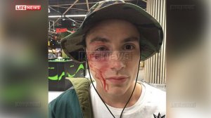 [це европа] В центре Киева избили солиста Quest Pistols