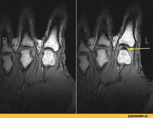 О хрусте пальцев