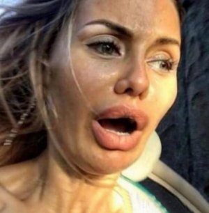 Виктория Боня напугала фанатов изуродованным лицом