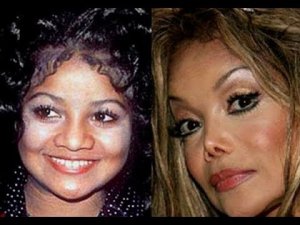 7 голливудских звёзд испортившие свою внешность ринопластикой